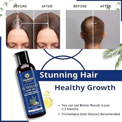 Moolveda 100% Pure Rosemary Hair Oil for Hair Growth - 100 ml