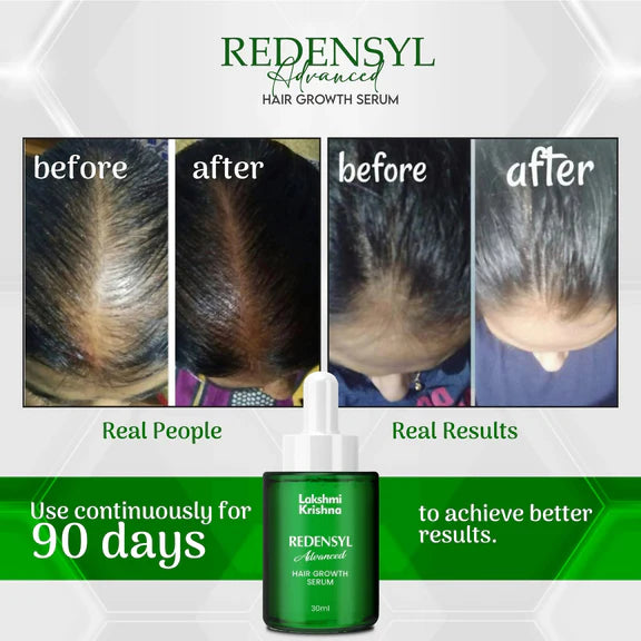 Lakshmi Krishna Naturals Redensyl Advanced Hair Growth Serum - 30 ml