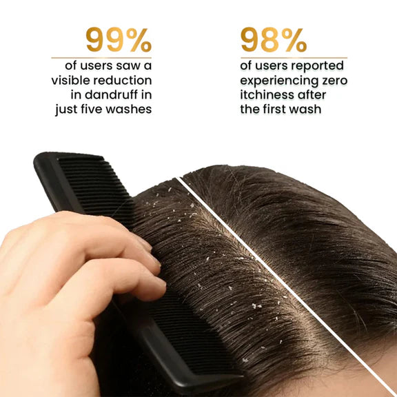 The Skin Story Anti Dandruff Deep Ceansing Shampoo Calms & Soothes Scalp With Saniscalp & Argan Oil - 250 ml