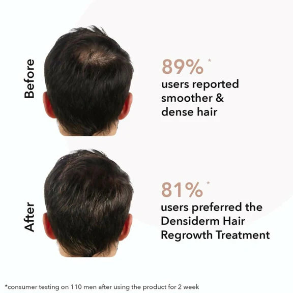 Professional O3+ Men Densiderm Hair Growth Scalp Serum Spray For Anti Hair Loss With Ginseng - 50 ml