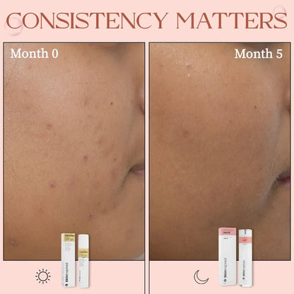 Desqua Mate - AHA BHA PHA Serum | 2% Salicylic Acid Face Serum