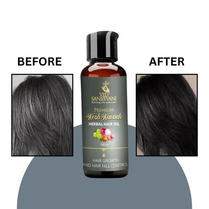 Ved Sanjeevani Kesh Kavach Herbal Hair Oil - 100 ml