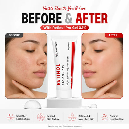 Retinol Pro Gel 0.1%
