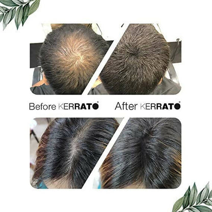 Kerrato Hair Fibres For Thinning Hair - Jet Black - 11.5 gm