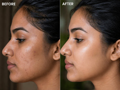 Glass Skin CTM Ritual | Brightening Ayurvedic Skincare Combo