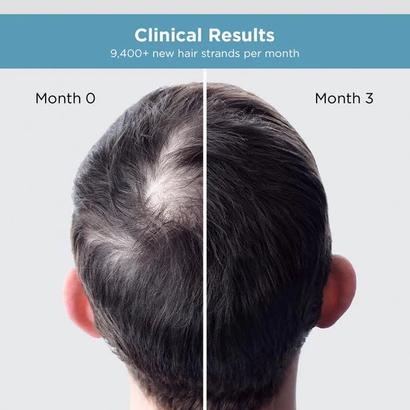 The Man Company Hair Growth Serum For Man - 30 ml