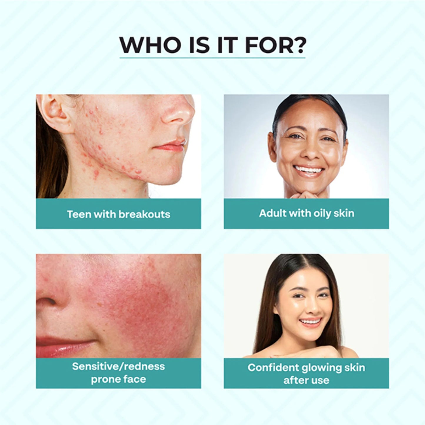 Dr.Sakhiya Acne & Pimple Care Kit - kit
