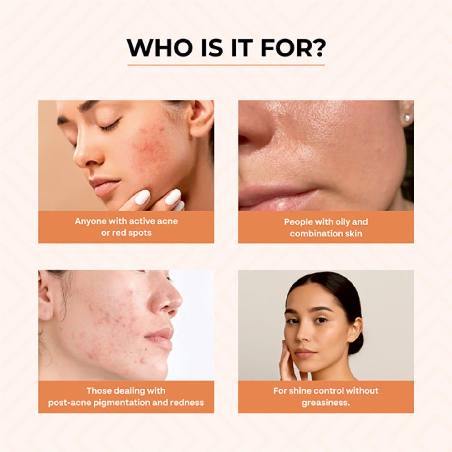 Dr.Sakhiya Acne & Pimple Morning Cream - 50 gm