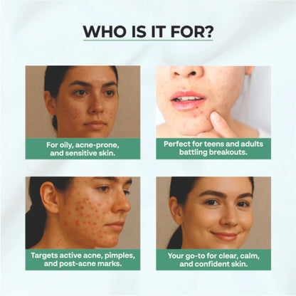Dr.Sakhiya Acne & Pimple Moisturizer - 100 gm