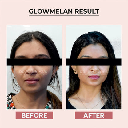 Dr.Sakhiya Glowmelan Brightening & Depigmentation Gel Cream - 50 gm