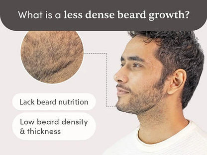 Man Matters Beardmax Growth Serum, Minoxidil 5% - 30 ml