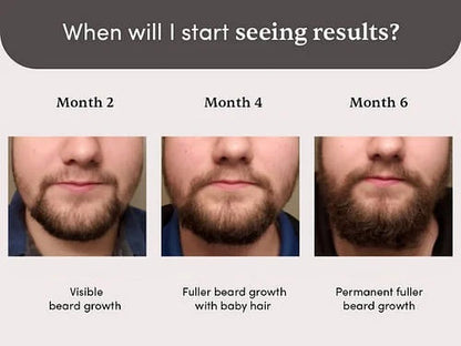 Man Matters Beardmax Growth Serum, Minoxidil 5% - 30 ml