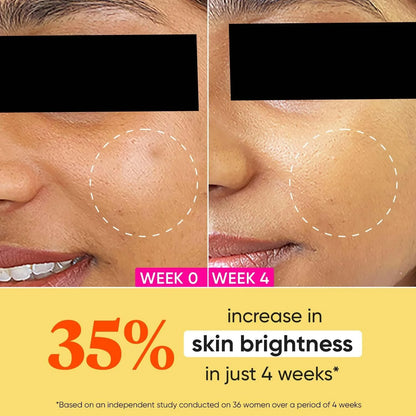 Dot & Key Vitamin C+E Super Bright Moisturizer - 25 ml