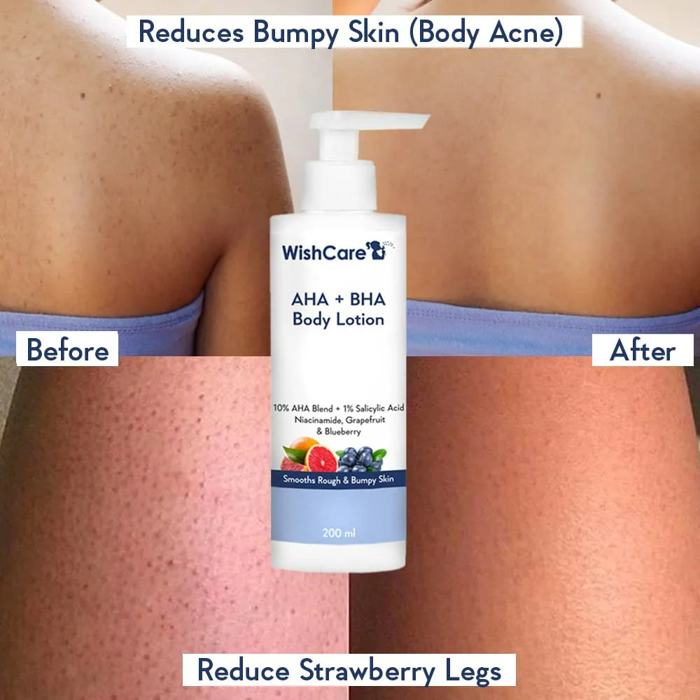 WishCare 10% AHA + 1% BHA Body Lotion for Smooths Rough & Bumpy Skin