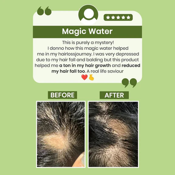 Alps Goodness Rosemary Water for Hair Regrowth - 200 ml