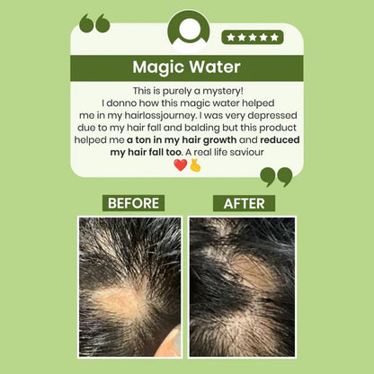 Alps Goodness Rosemary Water for Hair Regrowth - 200 ml