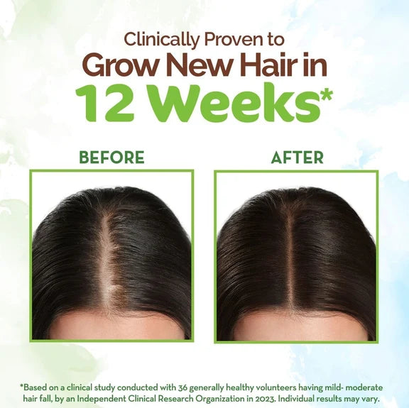 Mamaearth Rosemary Hair Growth Oil with Rosemary & Methi Dan