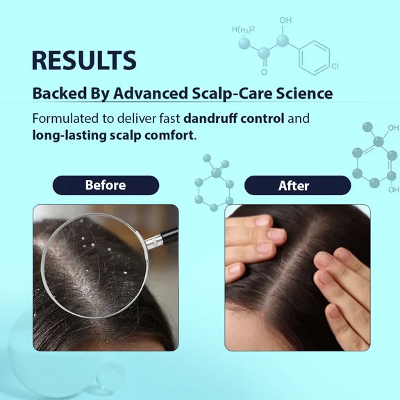 Dermistry Anti-Dandruff Control Hair Serum & Shampoo - combo