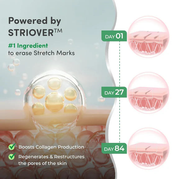 Mylo Care Stretch Marks Combo - Combo