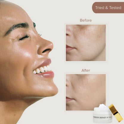 Dromen & Co Manuka Honey & Yoghurt Serum Moisturiser - Hydrates & Deep Nourishes, Reduces Wrinkles - 50 gm