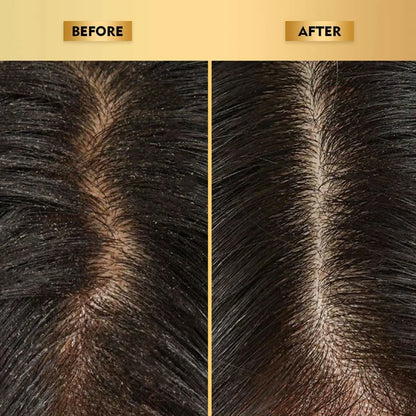 The Skin Story Anti-Dandruff Hair Scalp Serum - 40 ml