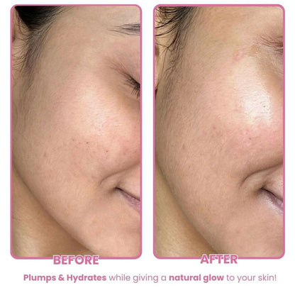 The Skin Diet Company Beetroot Moisturiser Lightweight, Non-Greasy - Dry/Oily Skin + Hyaluronic Acid - 15 ml