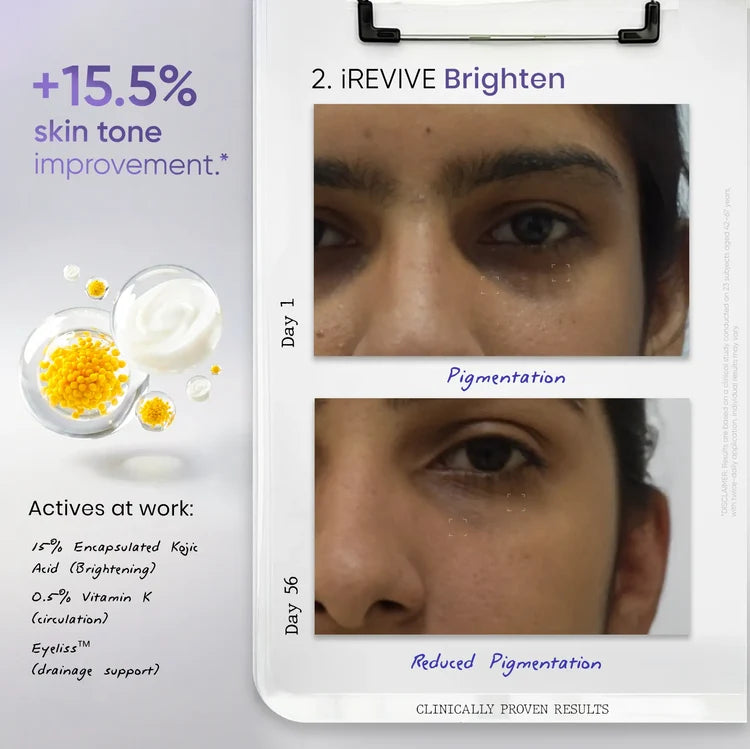 iREVIVE Under Eye Serum (24ml) | For Dark Circles, Fine Lines & Puffiness