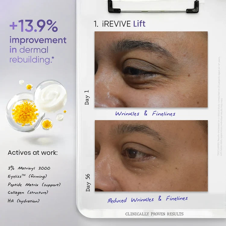 iREVIVE Under Eye Serum (24ml) | For Dark Circles, Fine Lines & Puffiness