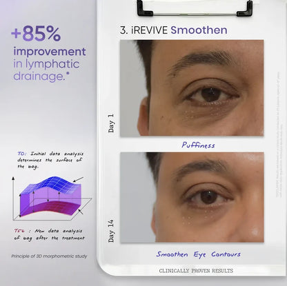 iREVIVE Under Eye Serum (24ml) | For Dark Circles, Fine Lines & Puffiness