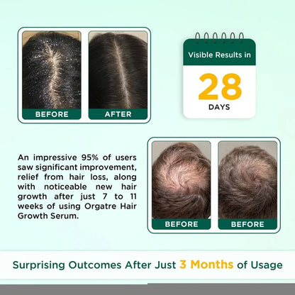 Orgatre Hair Growth Oil With 28 Herbal Oils ??Promotes Hair Growth, Reduces Hair Fall & Dandruff - 100 ml