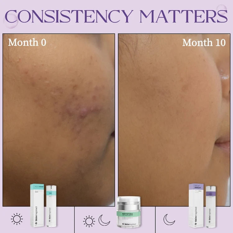 Night Knight - 2% VitAlease Retinol Serum for Face