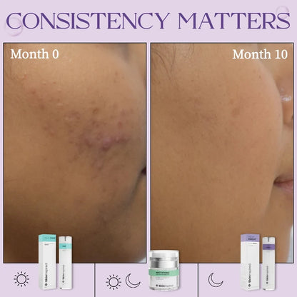 Night Knight - 2% VitAlease Retinol Serum for Face