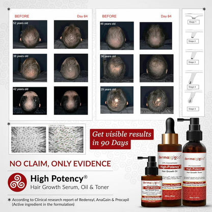 Derma Global High Potency Hair Growth Serum - 30 ml - Pack of 1