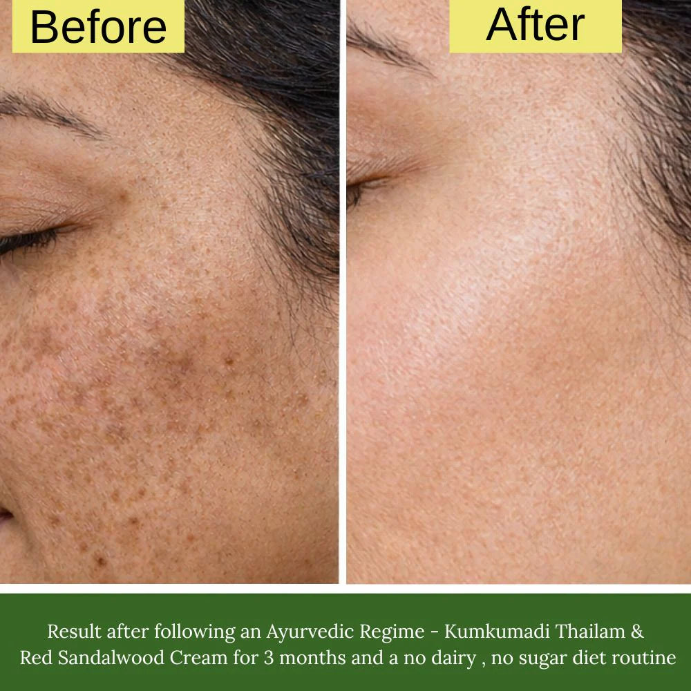 Kumkumadi Thailam Skin Brightening, Tan Removal & Anti-Ageing Night Face Oil