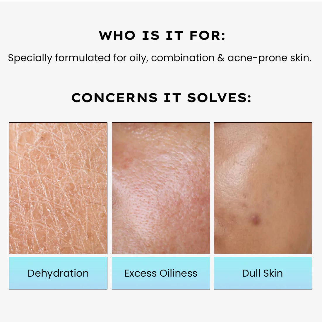 Hyphen 2% Cica Exosome Oil-Free Moisturizer 5% Niacinamide Controls Oil Non-sticky, Light Gel - 50 ml