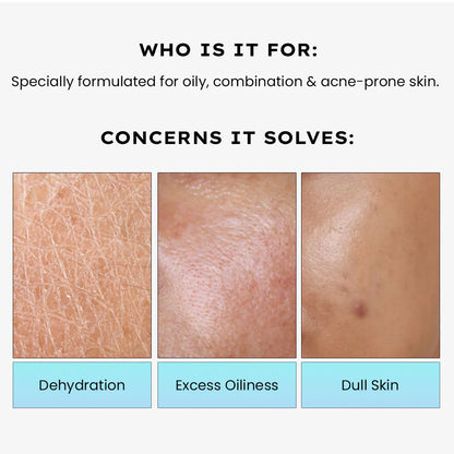 Hyphen 2% Cica Exosome Oil-Free Moisturizer 5% Niacinamide Controls Oil Non-sticky, Light Gel - 50 ml