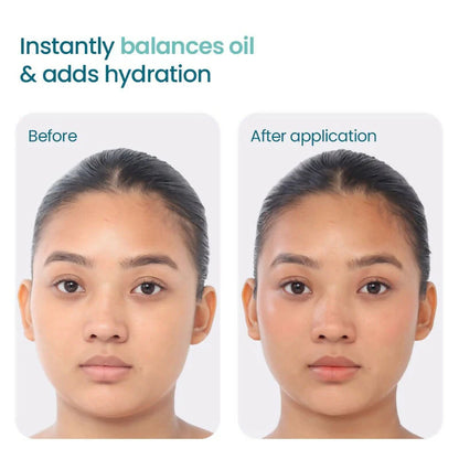 Wishcare 2:1:3 NMF Water Gel Moisturizer for Oily & Sensitive Skin, Oil-Free - 50 ml
