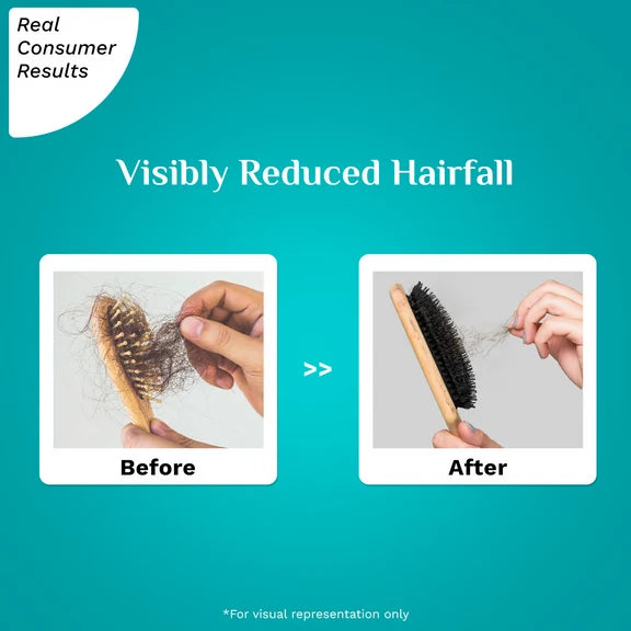 Pilgrim Rootactive Anti-Hairfall Serum - 30 ml