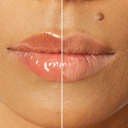 The Skin Diet Company Lip Barrier Oil Clear Gloss with Peptides Hydrates, For Dry & Pigmented Lips - 5 ml