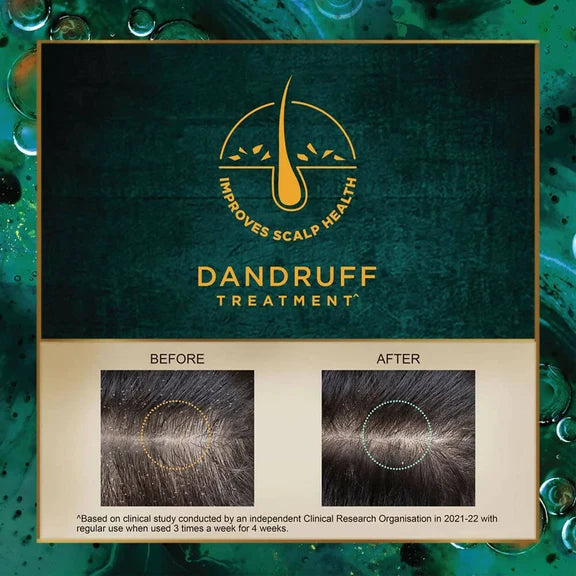 Indulekha Svetakutaja Anti-Dandruff Hair Oil - 100 ml