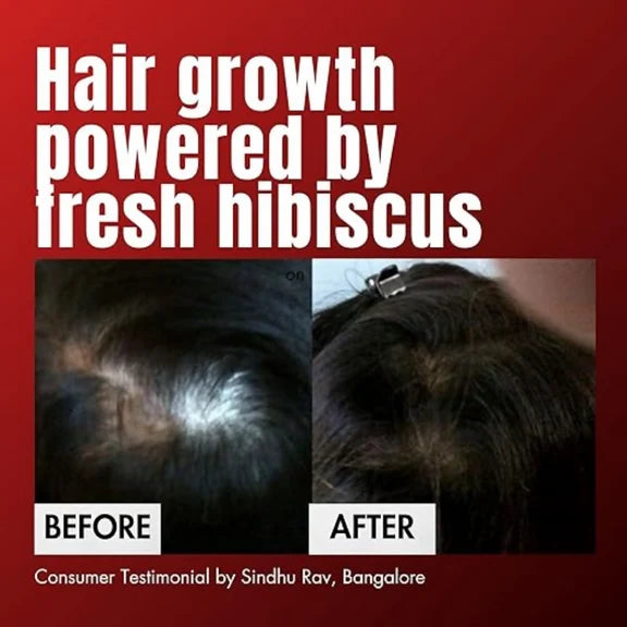 Hibiscus Monkey HM Love Scalp & Hair Oil - 100 ml
