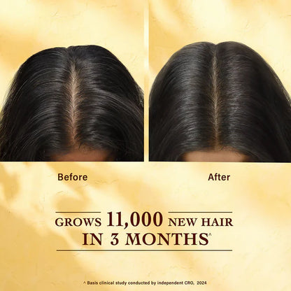 Indulekha Bringha Hair Growth Treatment Scalp Serum - 30 ml