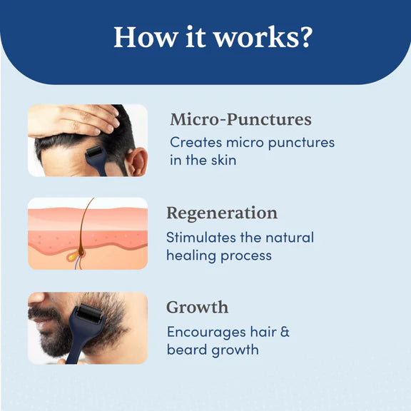 Man Matters Advance Derma Roller For Hair & Beard - 540 Micro 0.5mm Titanium Alloy Needles - 0.5 mm