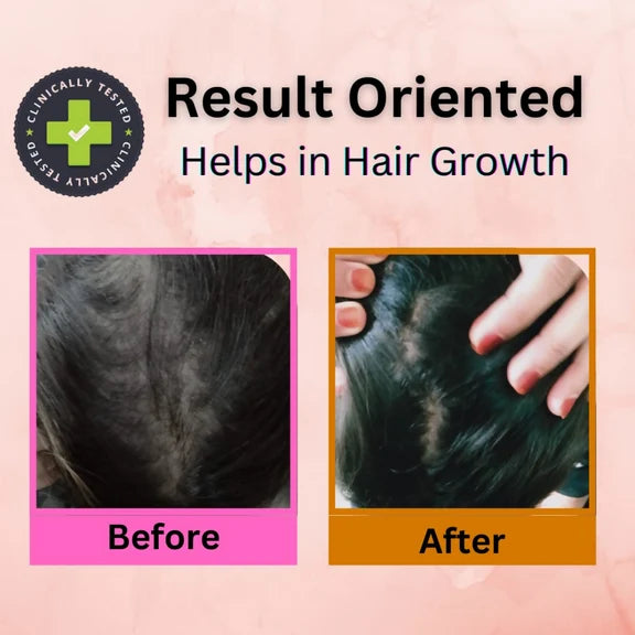 Curista Naturals Arnica Jaborandi Hair Growth Oil - 200 ml