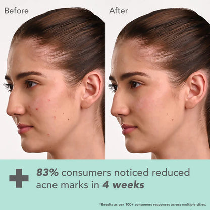 Lotus DermaBotanics Kojic acid + Multi Berry Face Serum