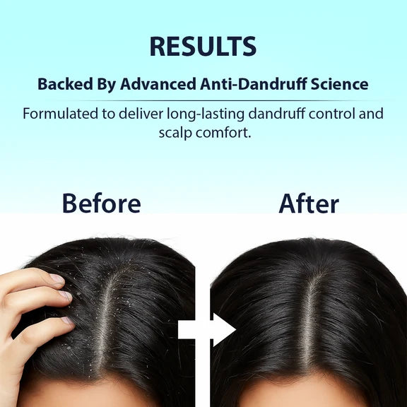 Dermistry Anti-Dandruff Control Shampoo Mask & Serum - combo