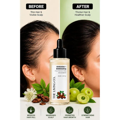 THE LIVING CO. Shikakai + Bhringraj Stimulating Scalp Serum - 65 ml