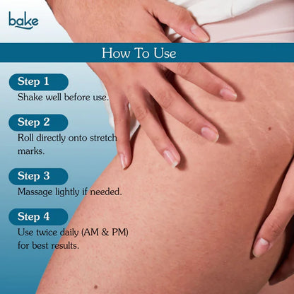 Bake StriErase™ Stretch Marks Removal Roll-On Serum - 50 ml