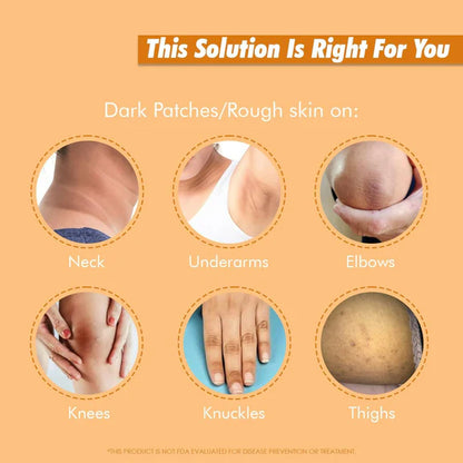 Exposed Whitening Cream For Intimate Areas Dark Underarms Elbows, Neck - 90 gm