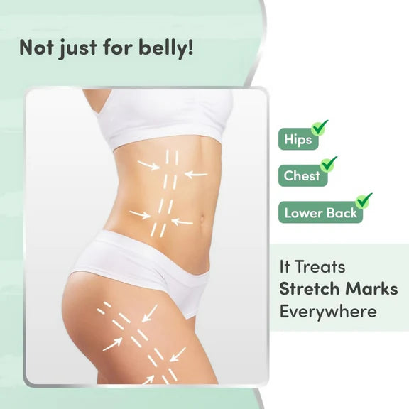 Mylo Care Stretch Marks Oil - with Sea Buckthorn - 100 ml